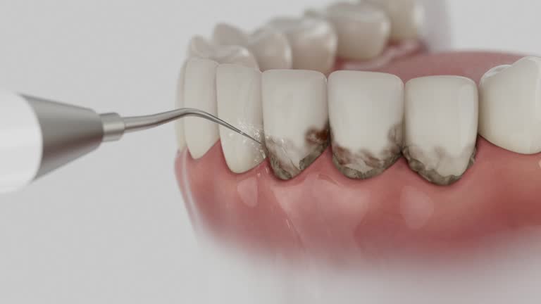 Reliable Dental Implants contractor in Newtown, PA by Smile Center Dentistry